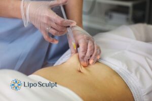 Does Skin Sag After Fat Dissolving Injections? 2 Do you want to get Aqualyx fat dissolving injections East Retford but worried about loose skin afterwards?