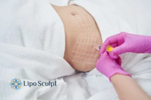 Are The Results From Aqualyx Permanent? 1 Do you want to know how long Aqualyx East Retford results last?
