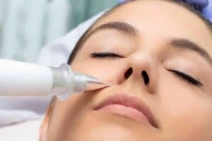 Best Actinic Keratoses Removal 3 Actinic keratoses East Retford solutions - book in today!